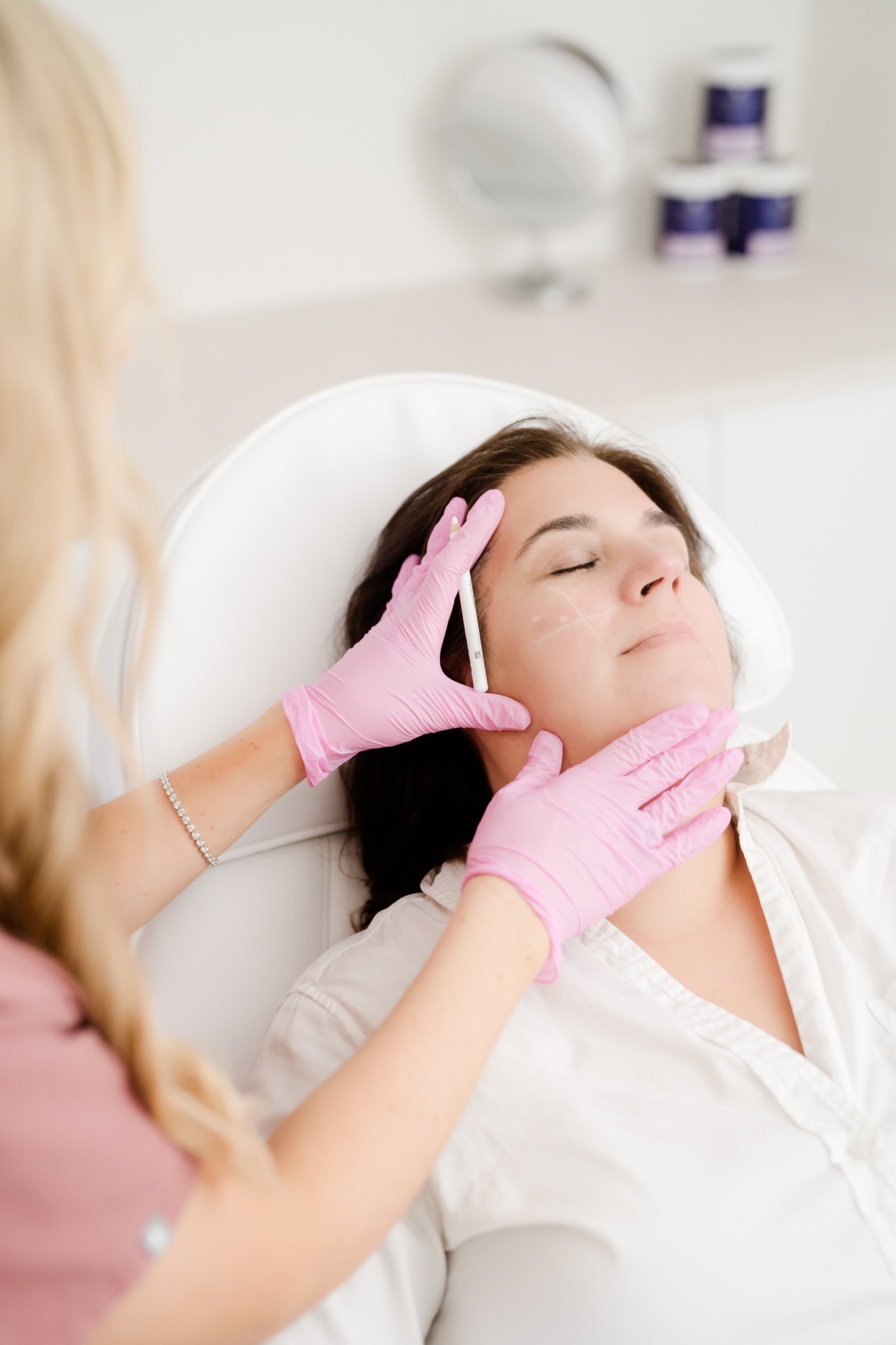 The area under the eyes is one of the most delicate parts of the face to treat and one of the most ageing when neglected.
Redensity is a hyaluronic acid product formulated specifically for this area and quite different to standard dermal filler. It is a thinner, more fluid formulation designed to integrate naturally into the delicate under-eye tissue without causing puffiness or the blue tinge that can occur when the wrong product is used here.
Redensity addresses hollowing under the eyes, dark circles caused by loss of volume, fine lines in the under-eye area and the general appearance of tiredness and fatigue. There may be mild swelling for 24 to 48 hours after treatment, easily covered with concealer. Results last approximately 9 to 12 months.
New clients receive a complimentary Blue Peel RADIANCE when booking their first injectable treatment this summer.
Link in bio to book a consultation.
— Simply Skin Clinic, Winchester
#RedensityExplained #UnderEyeTreatment #TearTrough #SimplySkinClinic #WinchesterAesthetics