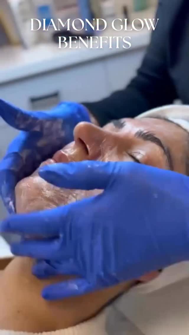 Why Choose a DiamondGlow™ Facial
🧖♀️ Medical-grade exfoliation: DiamondGlow™ uses a precision-crafted diamond tip to gently resurface the skin at a controlled depth — something that can only be performed in a medical setting.
🧖♀️ Deep serum infusion: Unlike traditional facials, the device simultaneously infuses professional-strength serums tailored to your skin’s needs (brightening, clarifying, or hydrating).
🧖♀️ Improved skin health, not just appearance: By promoting cell turnover and clearing congestion, DiamondGlow™ supports long-term skin function and clarity.
🧖♀️ Safe and supervised: Performed in a clinical environment under medical supervision, ensuring sterile technique, device calibration, and evidence-based protocols.
🧖♀️ Immediate and cumulative results: Patients notice smoother texture, refined pores, and a more radiant tone after one session, with progressive improvement over a series of treatments.
🧖♀️ Integrates with advanced skincare regimens: Complements other in-office procedures such as chemical peels, lasers, or injectables to optimize skin health outcomes.
🧖♀️ Not a spa facial: This is a dermatologic-grade treatment designed for results beyond surface hydration — addressing texture, tone, and overall skin rejuvenation.
To schedule an appointment:
📞Call 234 458 2010
📲DM @dr.vidhiadlakha
📧Email us info@adlakhaplasticsurgery.com
💻Visit the website in bio
.
.
.
This is an actual patient of Dr. Vidhi Adlakha. All photos are released with consent. Please do not use or distribute without permission.
#adlakhaaesthetics #microneedling #morpheus8 #collagen #diamondglow #hydrafacial #medicalfacial #medspa #collangenbanking #retinol #skincare #antiaging #diamondglowfacial #femalesurgeon #antiwrinkle #aesthetics #aestheticians #sculptra #skincareroutine #girlmath
#Microneedling #SkinHealth #CollagenBoost #texture #SkinGlow #PreventativeSkincare #AestheticDermatology #prp #prf #skincare #skincareroutine