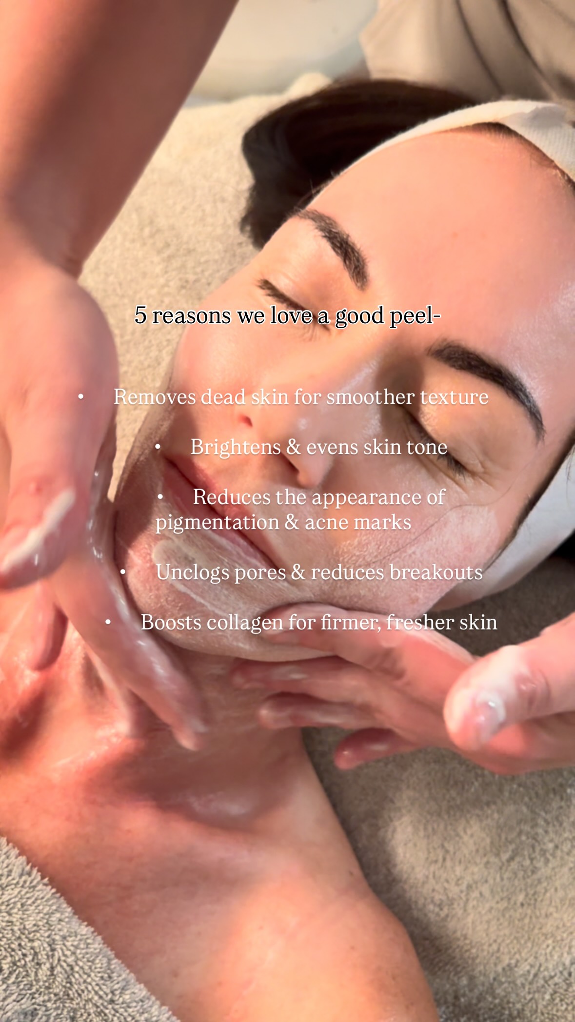 If your skinâs feeling dull, congested, or just in need of a reset đđźââď¸ a peel will leave you with fresh skin, brighter tone and smoother texture!
Our âlunch time peelâ is the perfect 45 minute treatment that delivers gorgeous results đđź