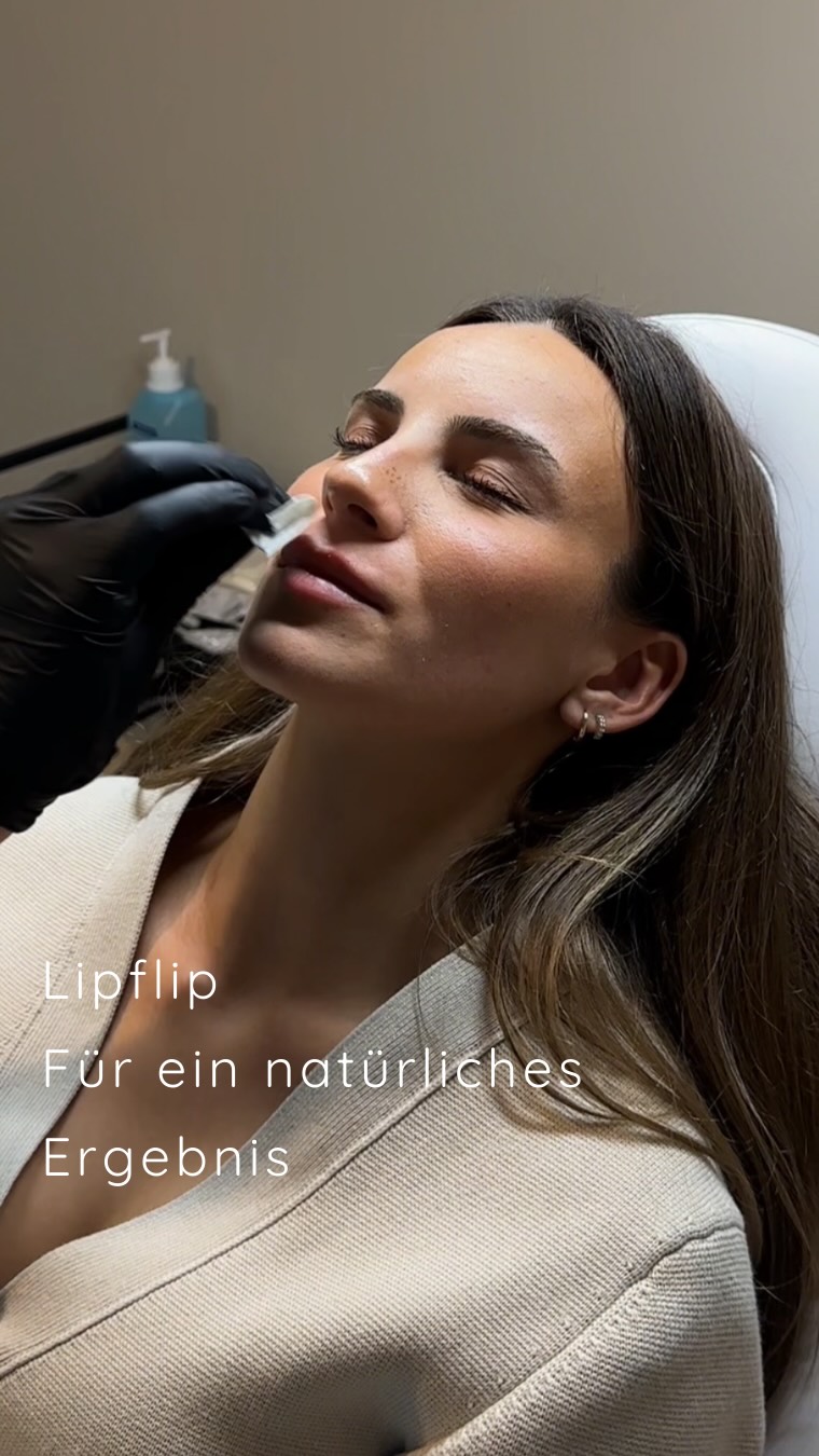 Du möchtest gerne eine vollere Oberlippe, möchtest sie aber nicht zwingend Aufspritzen? Ein Lipflip mit Botulinum entspannt den Muskel deiner oberen Lippe, bewirkt so optisch die Erscheinung einer volleren Oberlippe und führt dazu, dass man beim Lächeln das Zahnfleisch weniger sieht.
Die liebe @juliaavns hat euch bei ihrem ersten Lip Flip mitgenommen. 💉
Bist du Team Lipfiller oder Lipflip?👄