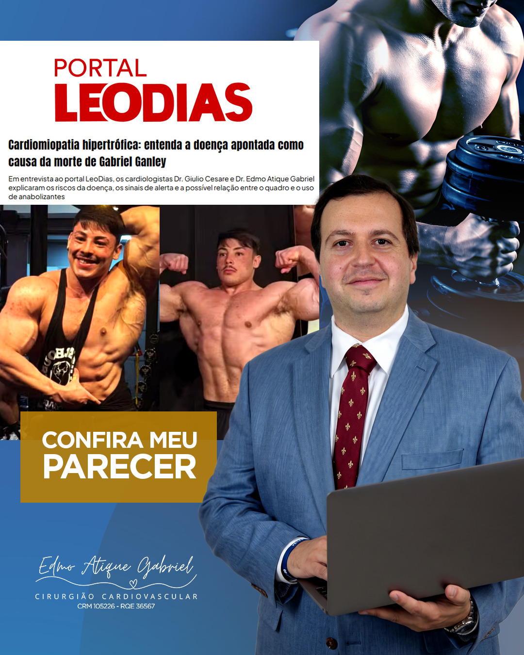 A trágica morte do jovem fisiculturista Gabriel Ganley, de 22 anos, acendeu um alerta grave. Como expliquei na minha entrevista ao @portal-leodias, a causa do óbito foi uma Cardiomiopatia Hipertrófica.
Essa doença faz o músculo do coração engrossar e ficar rígido, sendo a maior causa de morte súbita em atletas jovens. O grande perigo? Ela é silenciosa em 90% dos casos.
O uso de anabolizantes e estimulantes acelera e agrava drasticamente essa condição genética. O esporte deve ser sinônimo de saúde, não de risco. Se você treina pesado, faça um check-up cardiológico. Exames simples salvam vidas.
🔗 https://portalleodias.com/saude/cardiomiopatia-hipertrofica-entenda-a-doenca-apontada-como-causa-da-morte-de-gabriel-ganley
#DrEdmoAtique #Cardiologia #GabrielGanley #CardiomiopatiaHipertrofica #SaudeDoCoracao