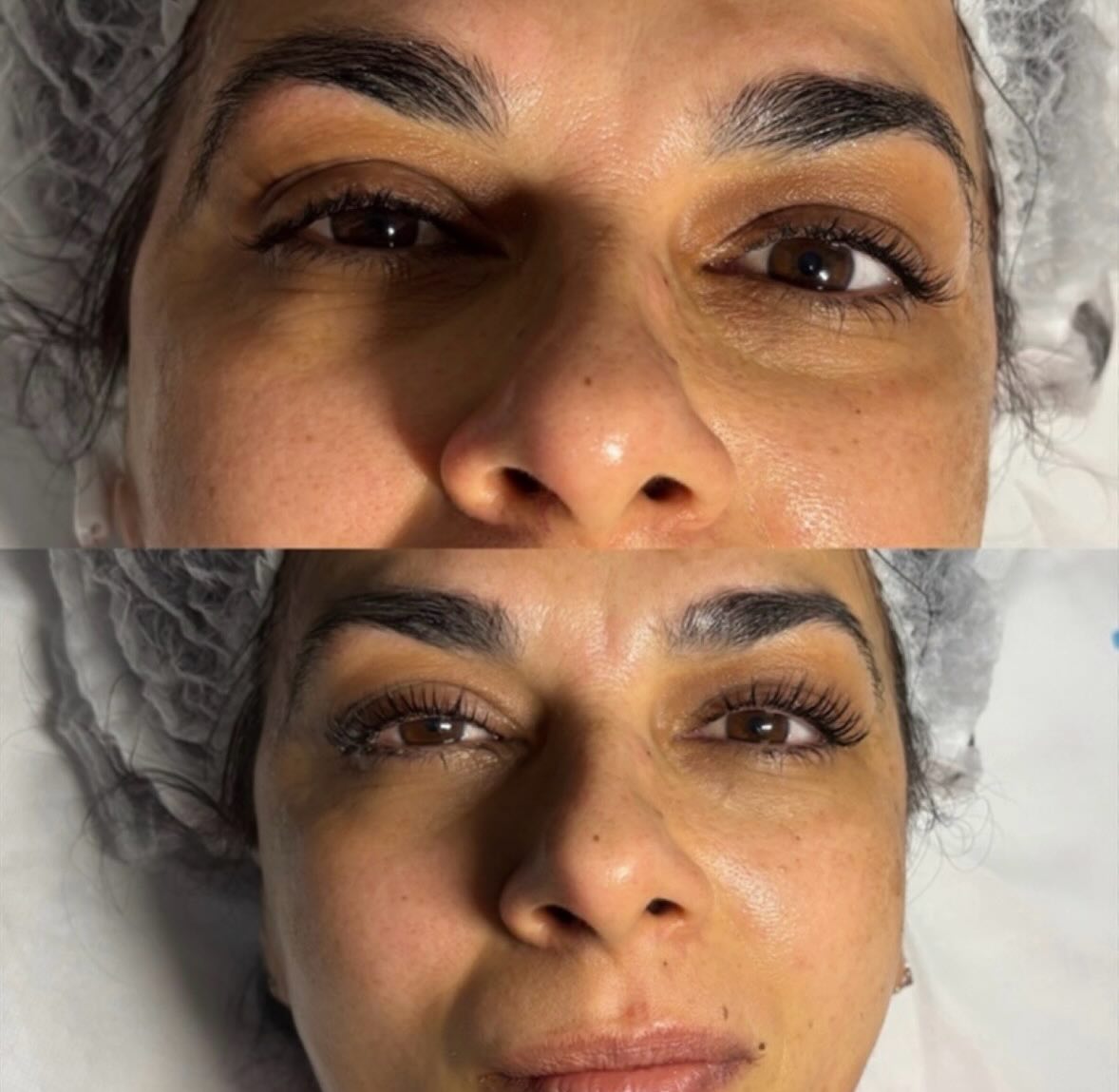 Natürlich geschwungene Wimpern ganz ohne Extensions ✨
Mit einem Lashlifting wirken die eigenen Wimpern länger, dichter und perfekt geformt – für einen frischen, offenen Blick vom Aufstehen bis abends 🤍
Kein tägliches Biegen der Wimpern mehr und trotzdem ein wunderschön natürlicher Effekt.
Wir lieben dieses leichte, gepflegte Ergebnis ✨
#lashlifting #lashes #naturallashes #lashlove #beauty wimpernlifting lasheffect kosmetikstudio glowup salonjuna