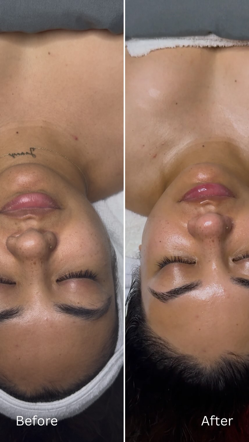 A Custom 90 min facial really is THAT GIRL.
Dm me now to get your skin looking like this glazed doughnut. #pearlessencebeauty #sonomacounty #skinprogress